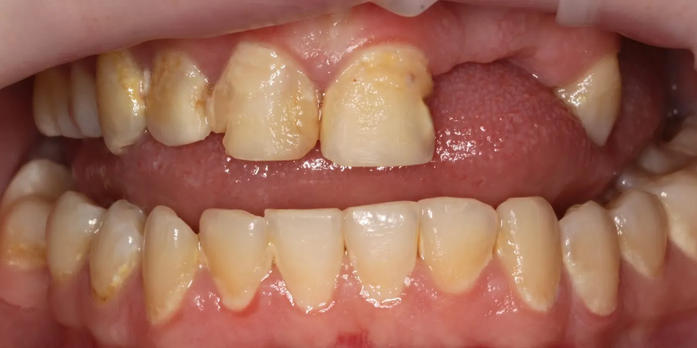 Case 1, before treatment