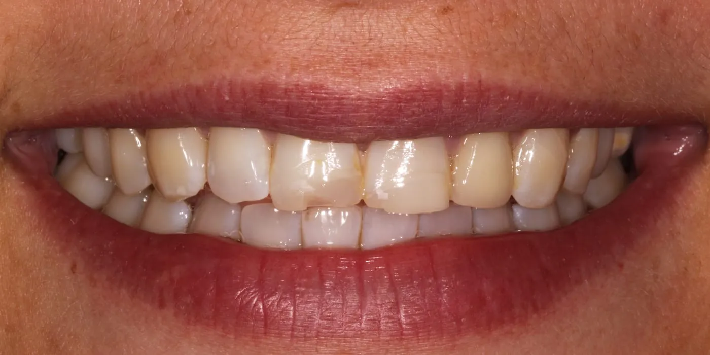 Case 2, before treatment