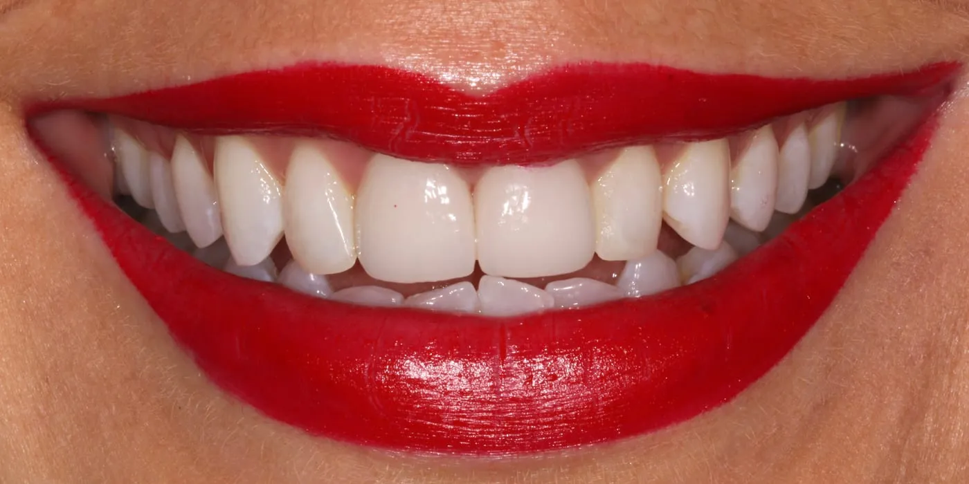 Case 3, after treatment