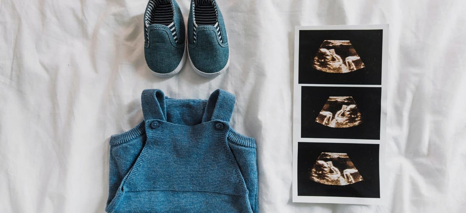 Baby clothes and shoes beside ultrasound pictures