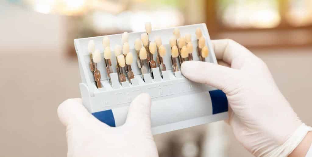 A dental shade guide held in gloved hands