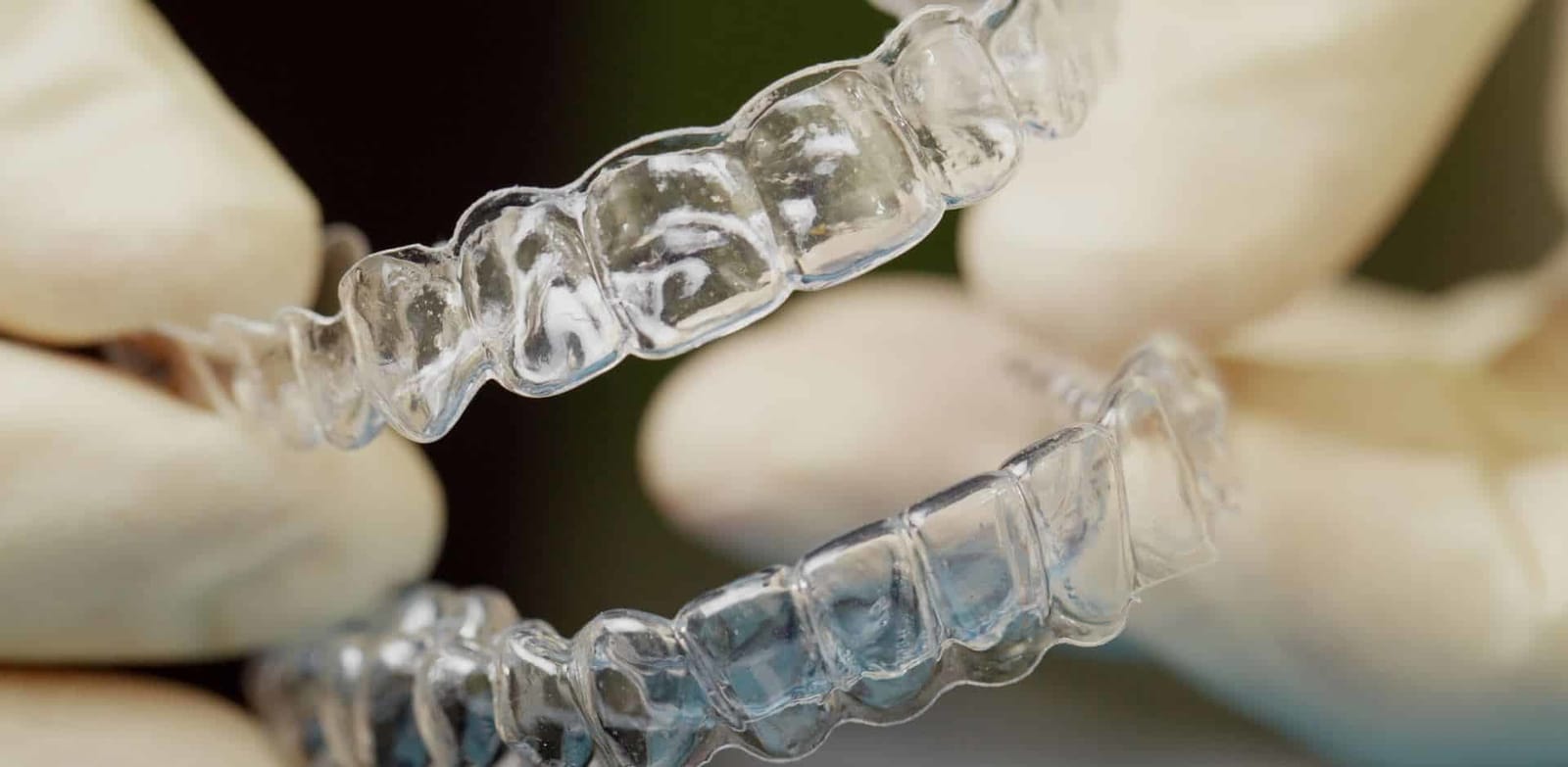 Clear dental trays fitted over a model of teeth