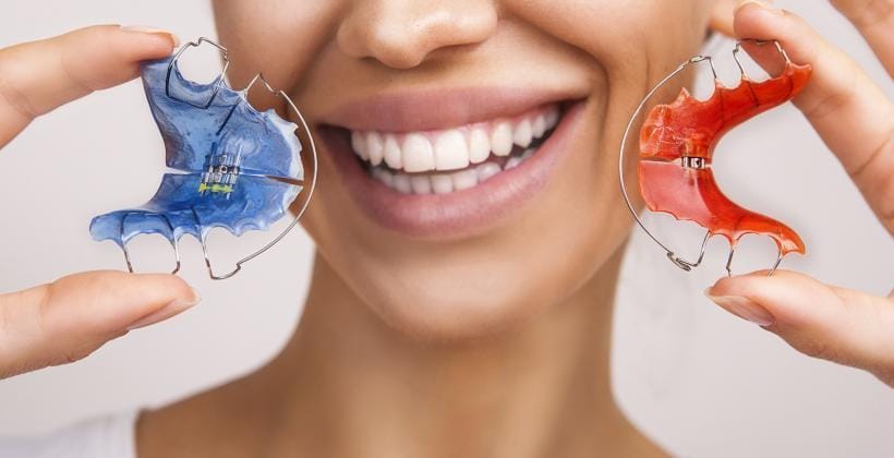 A woman holding blue and red removable orthodontic appliances