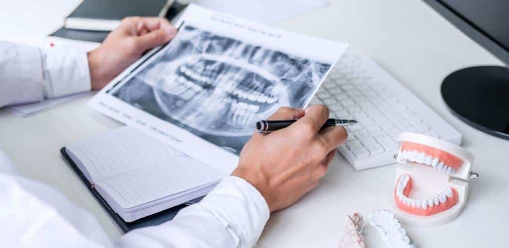 A clinician reviewing a dental X-ray beside a model of teeth