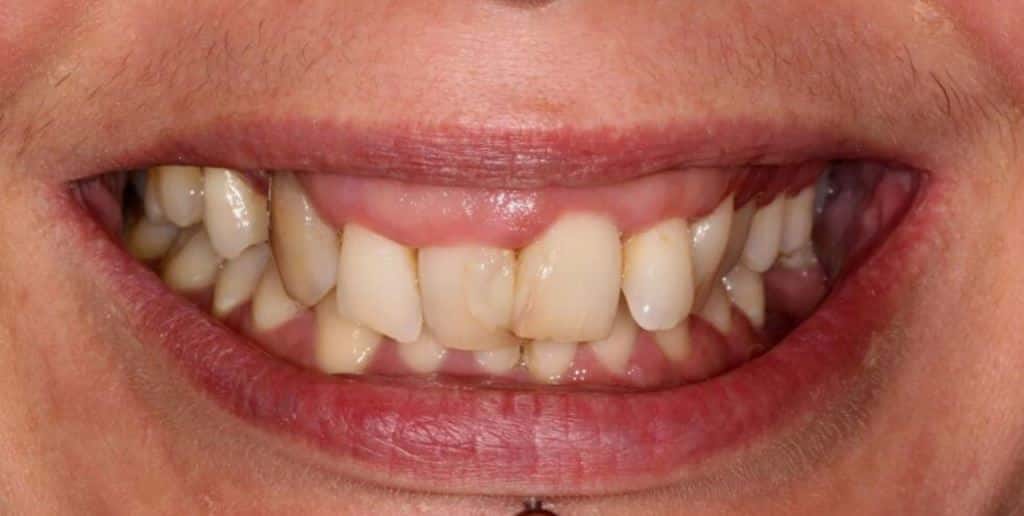 Close-up of a smiling mouth