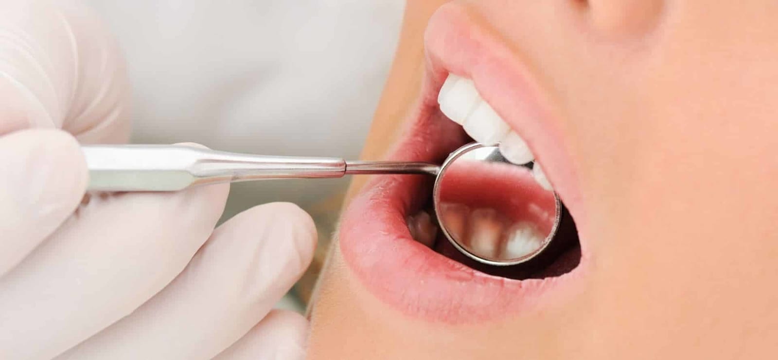 A dental mirror being used to examine teeth