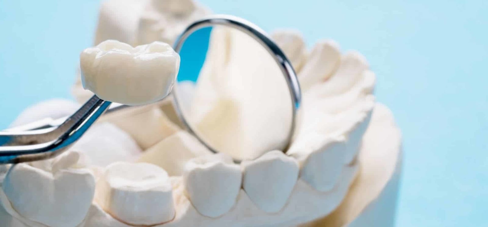 A dental crown held above a model of prepared teeth