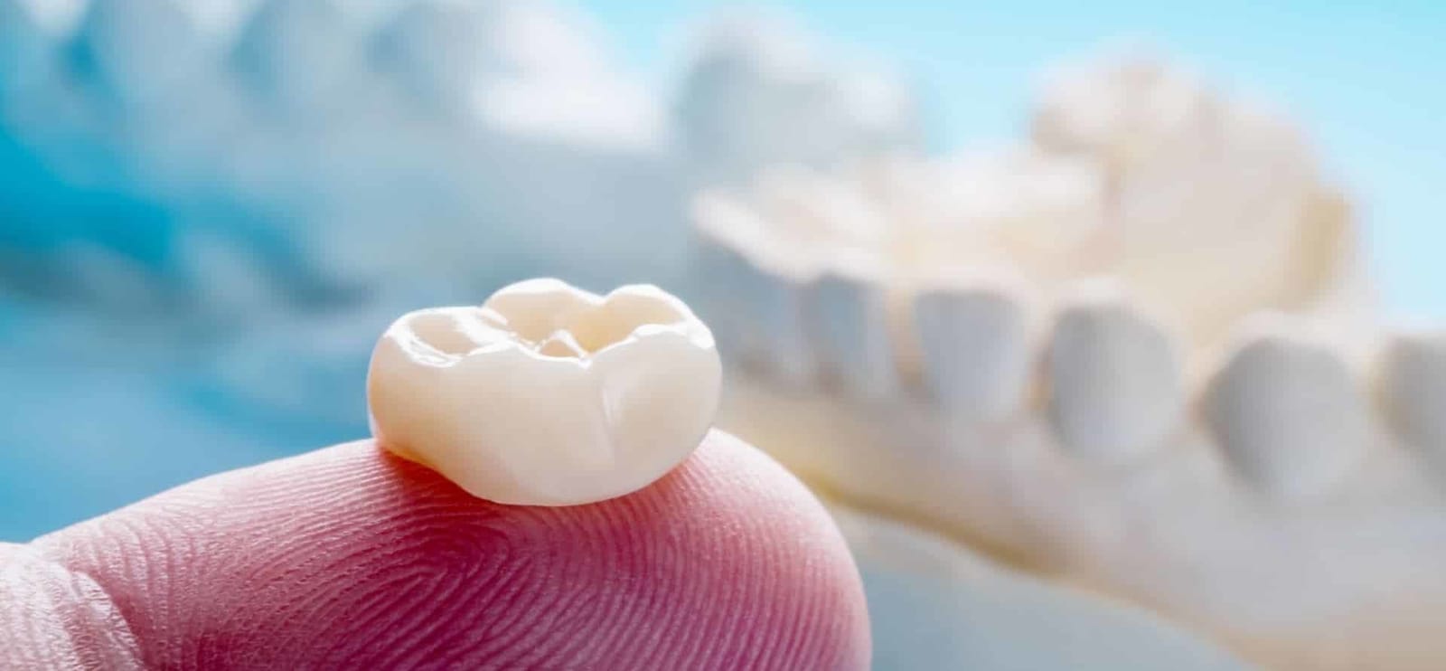 A tooth-coloured crown resting on a fingertip