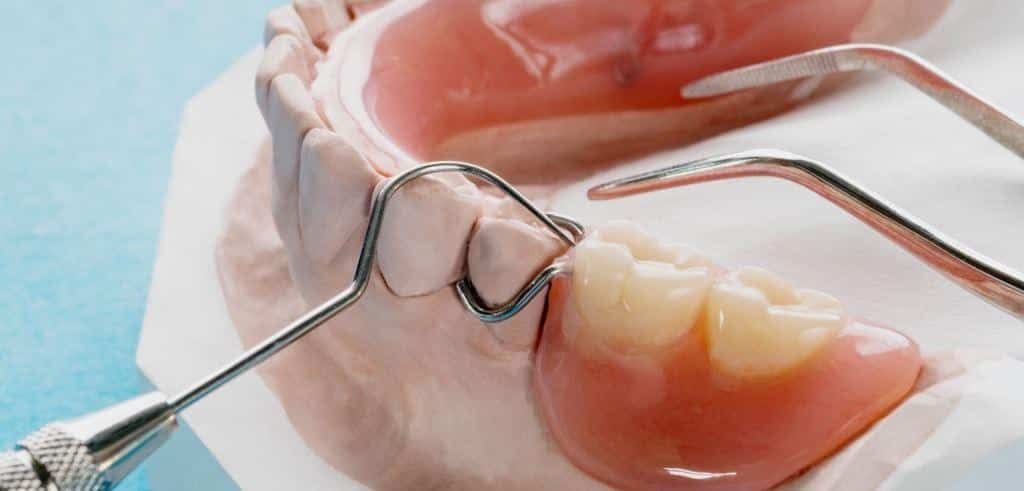 Partial denture on a model beside dental instruments
