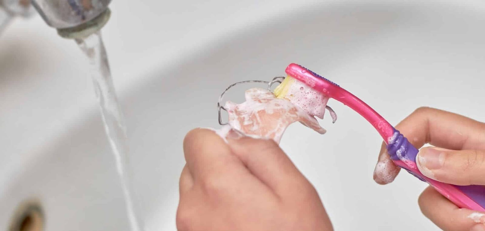 A removable orthodontic appliance being cleaned with a toothbrush