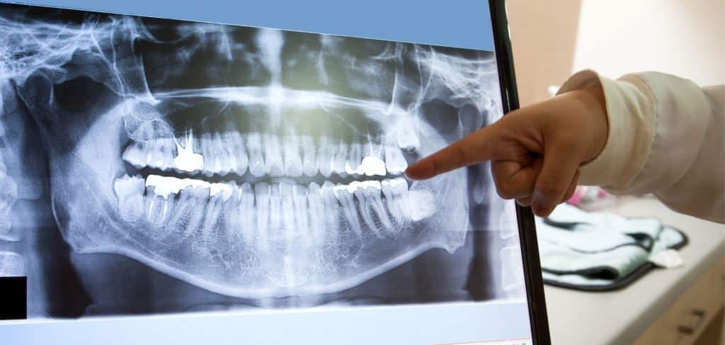 Dental X-ray being discussed on a screen