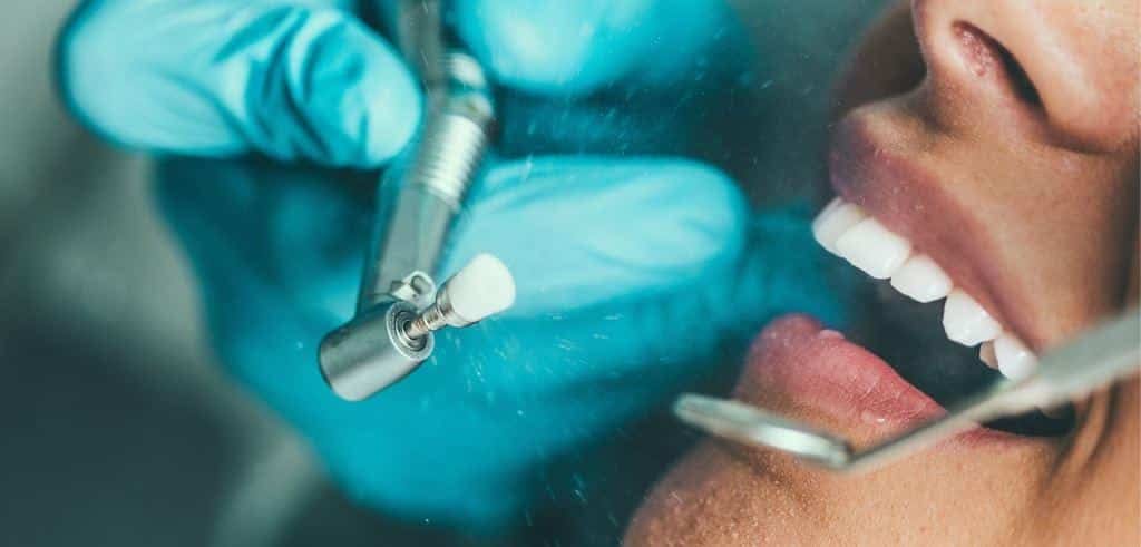 A dental polishing instrument held beside a patient’s teeth