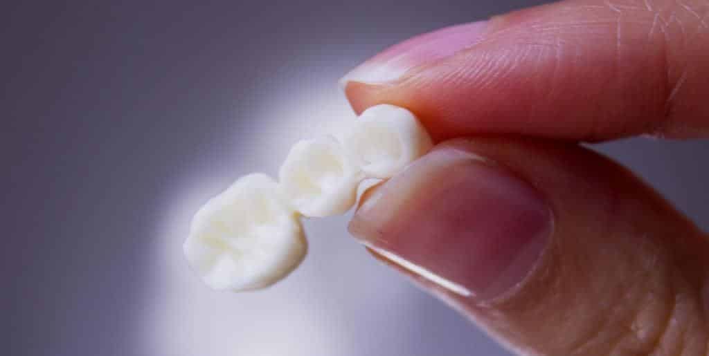 A hand holding a tooth-coloured dental bridge