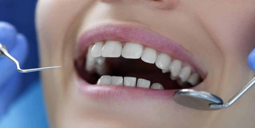 A close-up of teeth during a dental examination