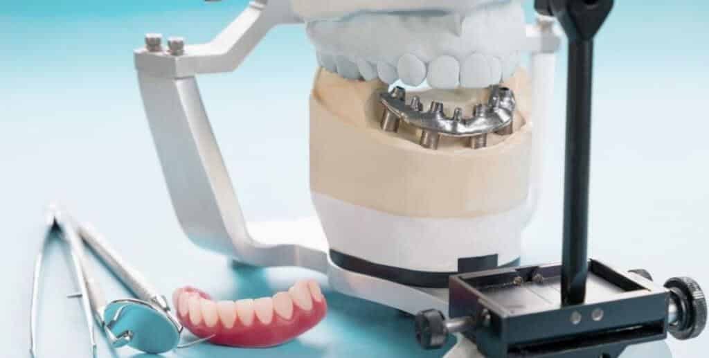 Dental models in an articulator beside a denture