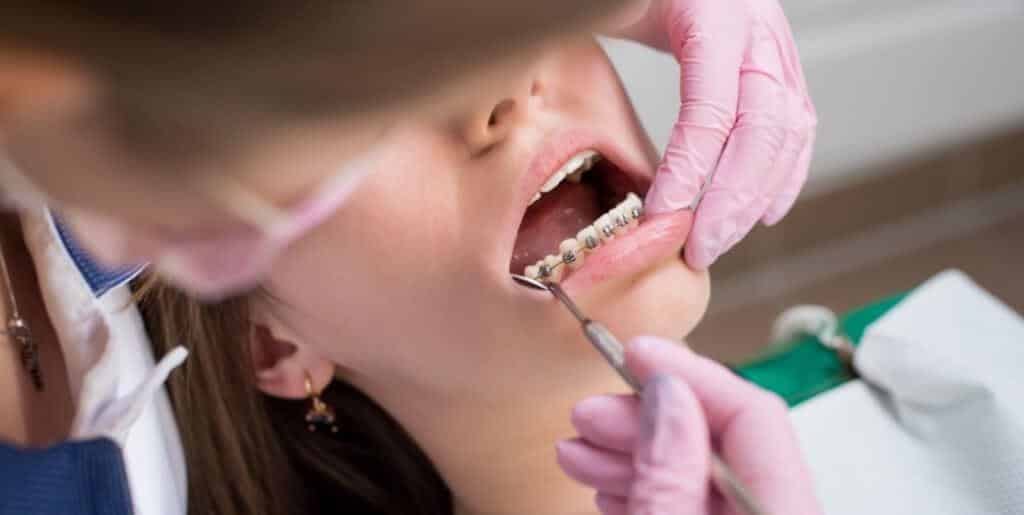 A clinician working around a patient’s fixed braces