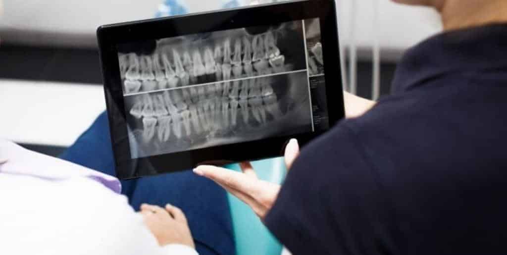 A dental X-ray displayed on a tablet during a discussion