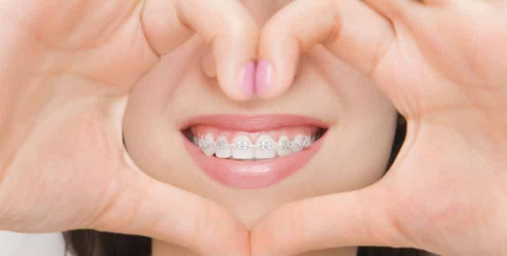 A smile with fixed braces framed by two hands