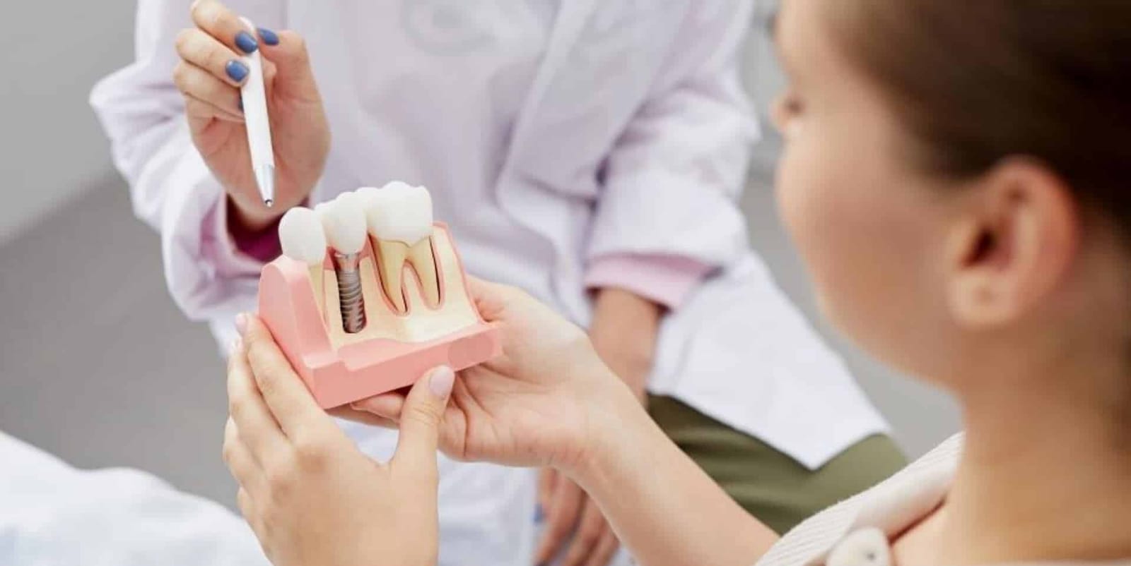 A clinician explaining an implant model to a patient