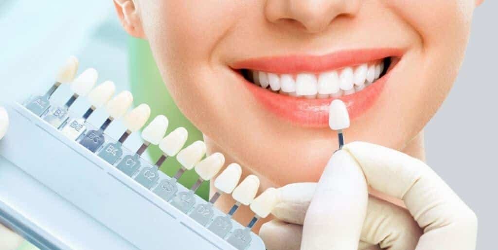 A tooth shade being compared with a patient’s teeth