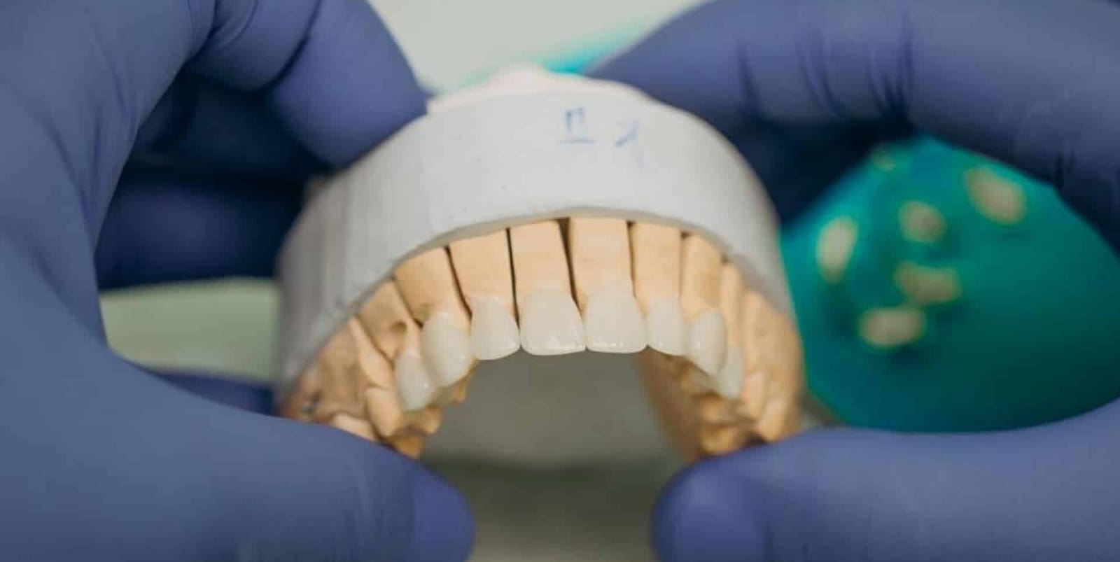 Dental professional holding a model of teeth