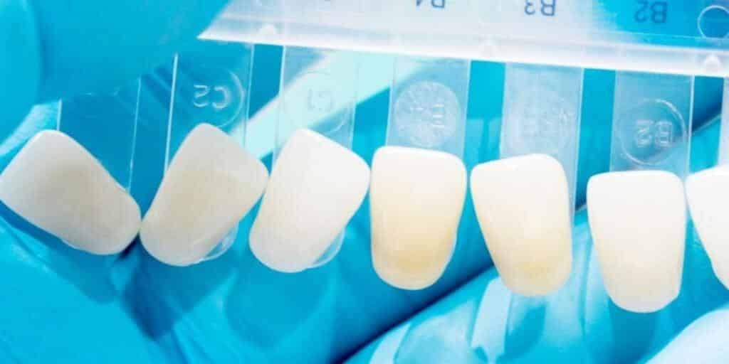 Tooth shade guide