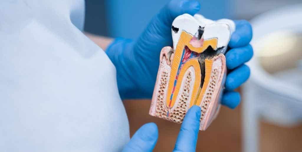 A cutaway tooth model showing its internal structure