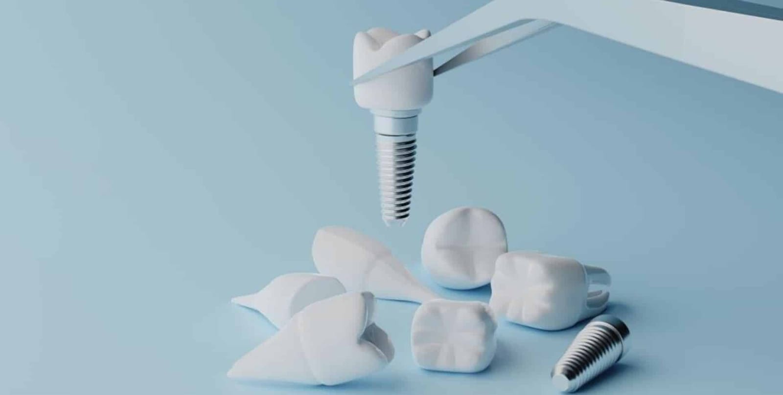 Illustration of dental implants and crowns on a blue background