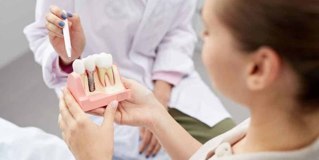 Dentist explaining an implant using a tooth model