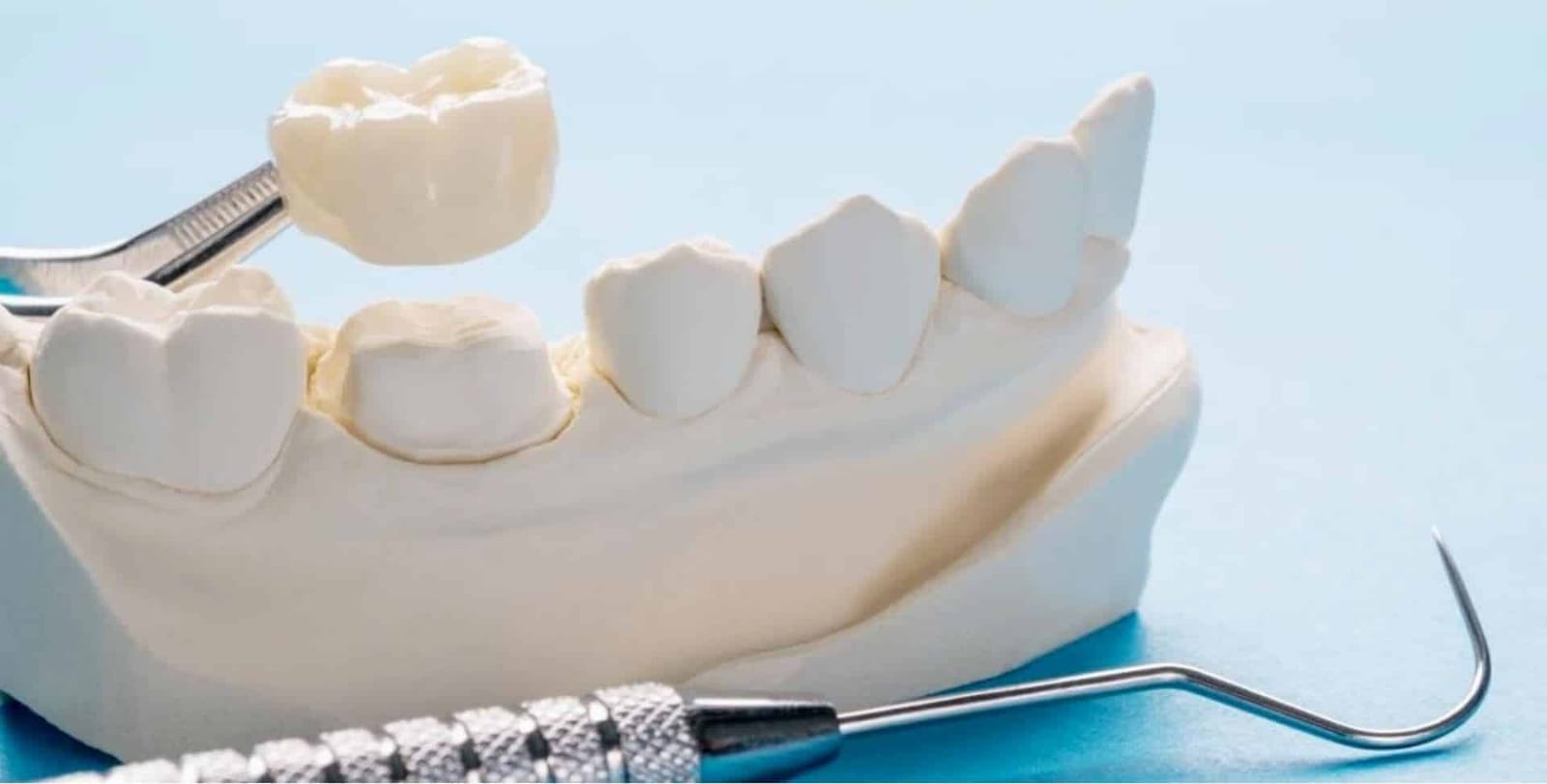 A crown held above a dental model beside instruments