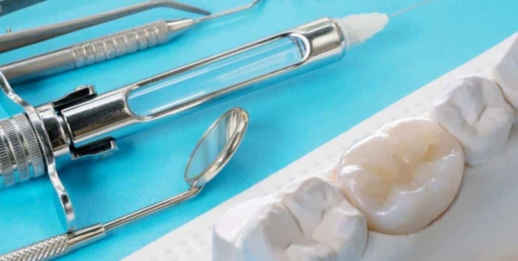 A dental model and crown beside a syringe and dental instruments