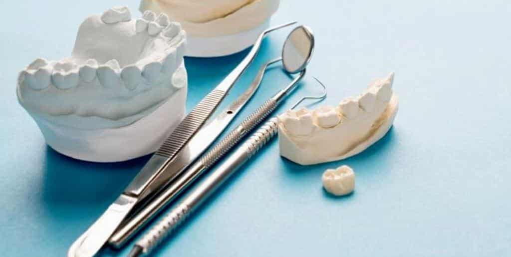 Dental models, a crown and metal instruments on a blue surface