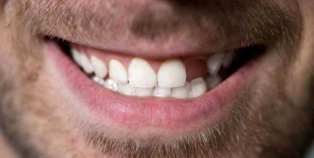 A close-up of a man’s smile