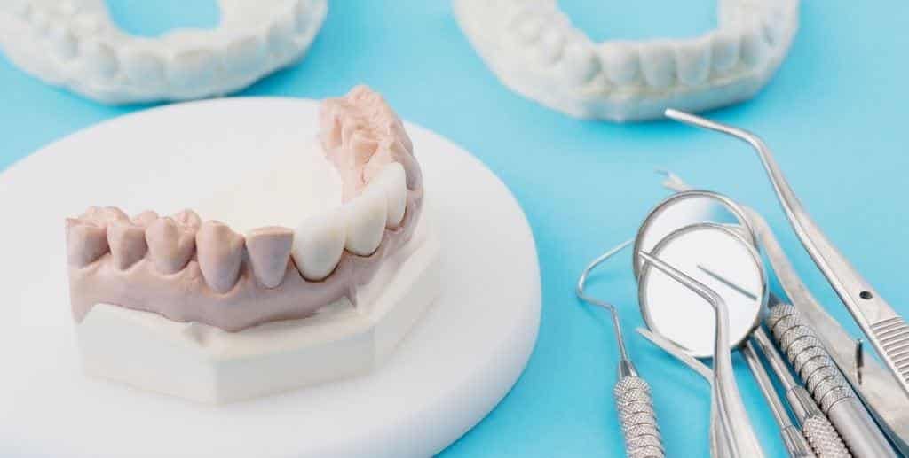 Dental models and instruments on a blue surface