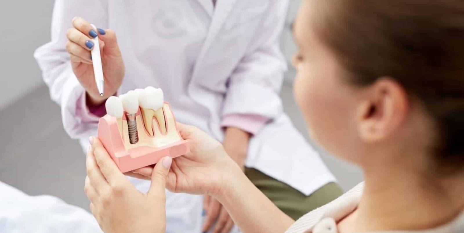 A clinician showing a patient an implant model.