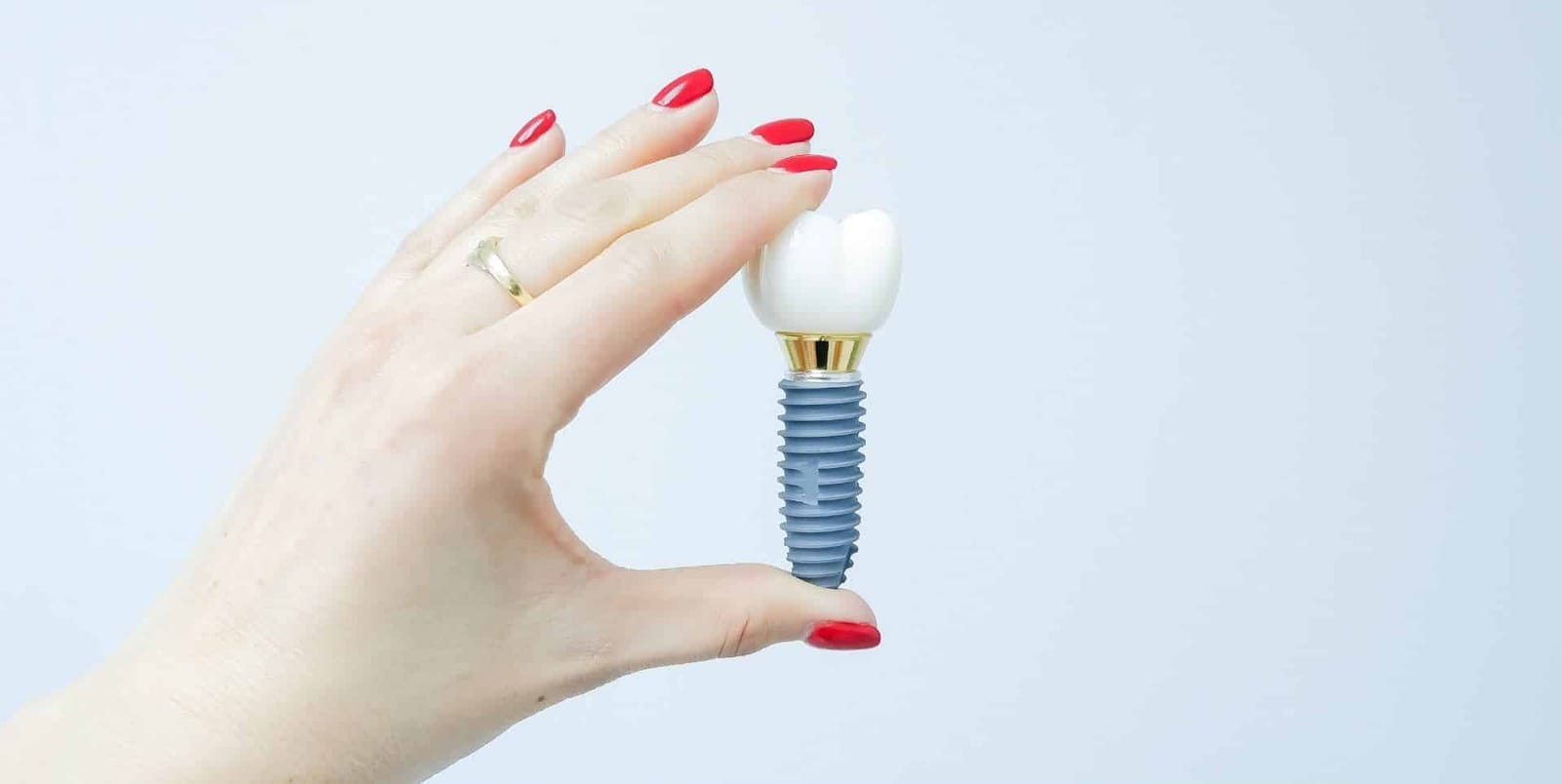 A hand holding a model of a dental implant and crown.