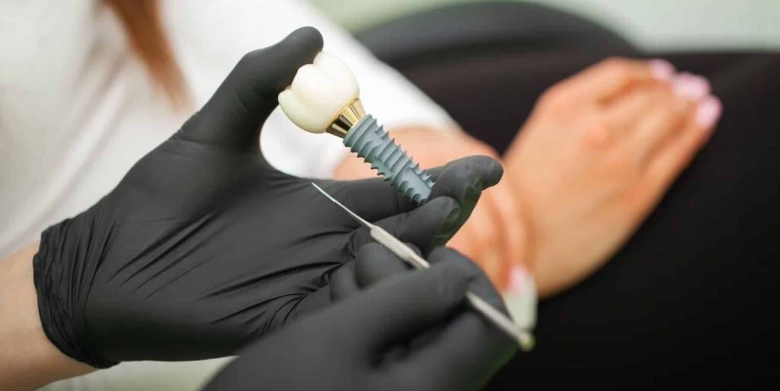 Gloved hands holding an implant model beside a patient.