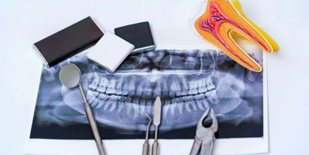 Dental instruments and a tooth model arranged over a panoramic X-ray