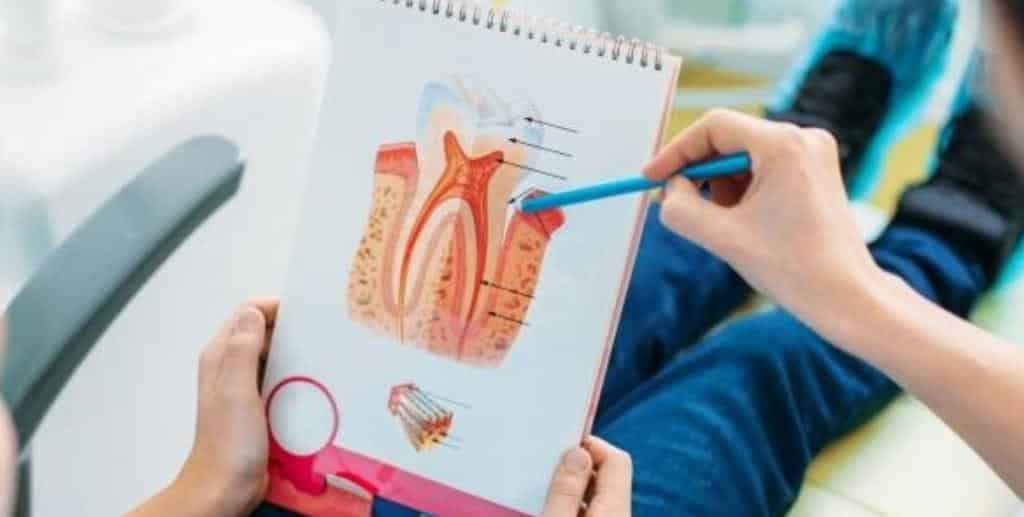 A tooth diagram being explained with a pen