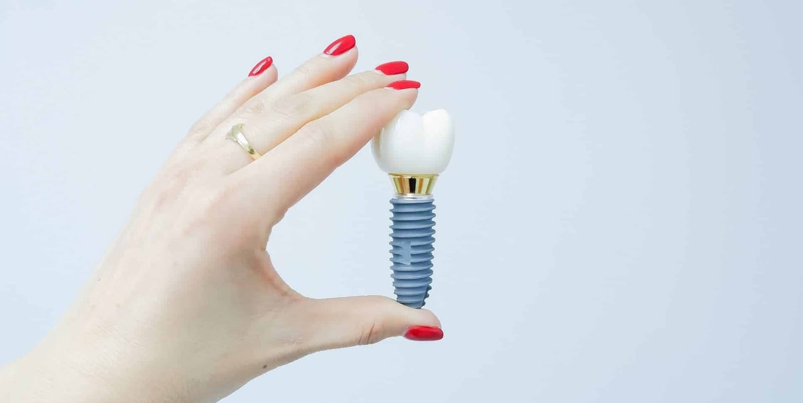 A hand holding a model of an implant and crown