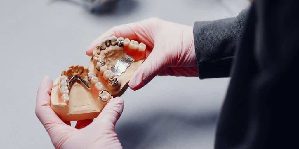 Gloved hands holding dental models with restorations