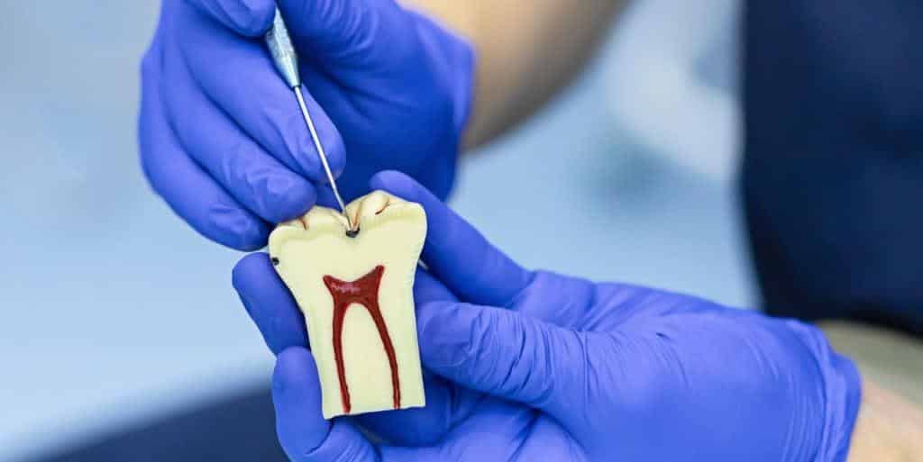 Gloved hands pointing to the chewing surface of a tooth model
