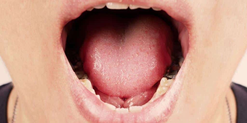 Open mouth showing the lower teeth and tongue