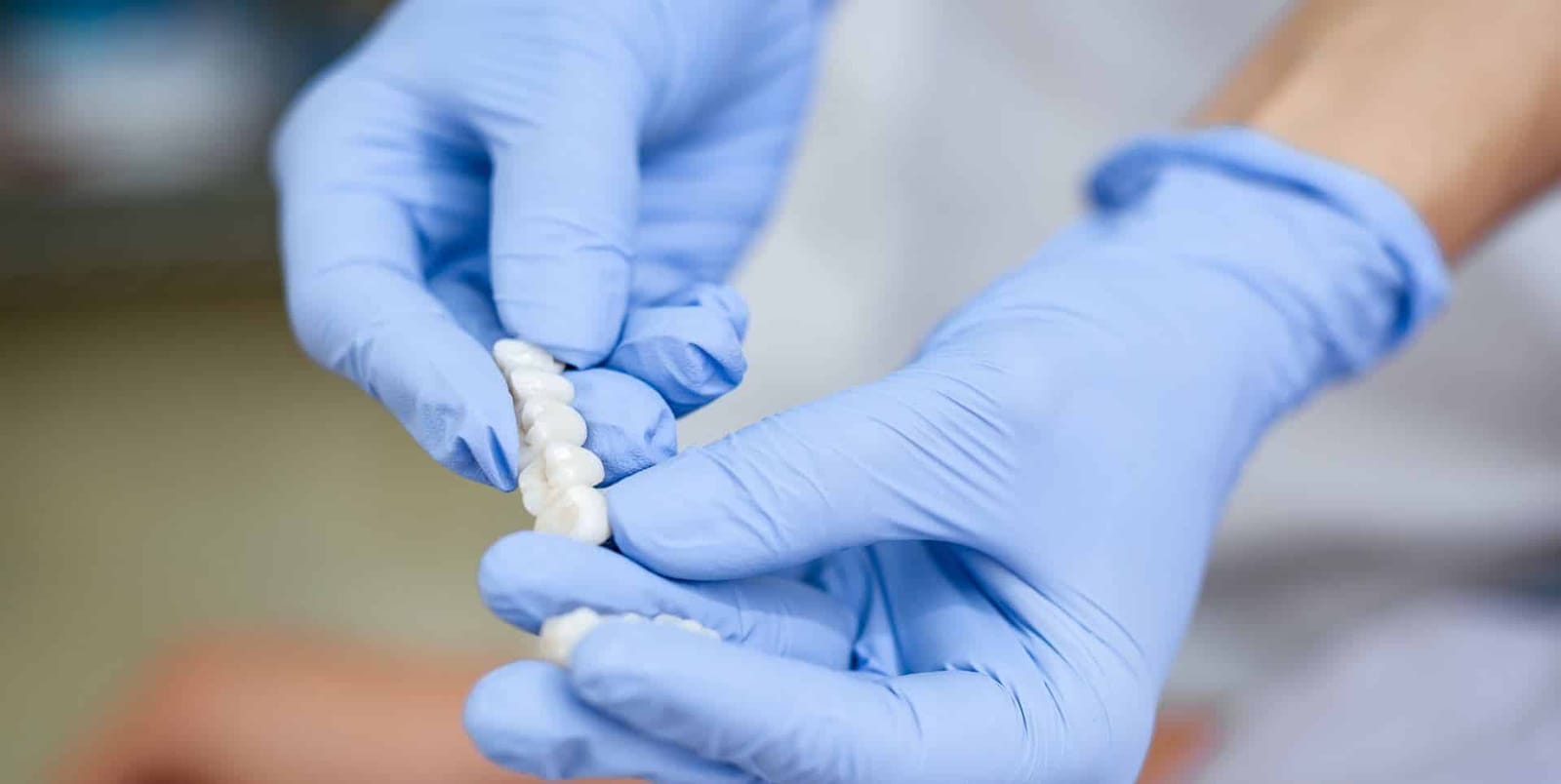 Gloved hands holding a tooth-coloured dental restoration