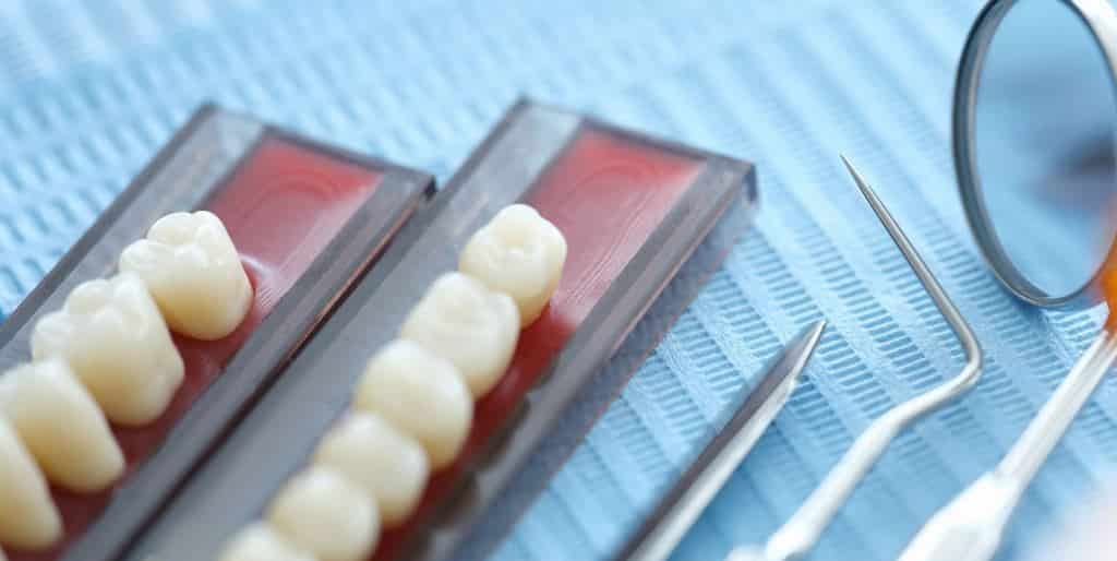 Tooth-coloured restorations displayed beside dental instruments