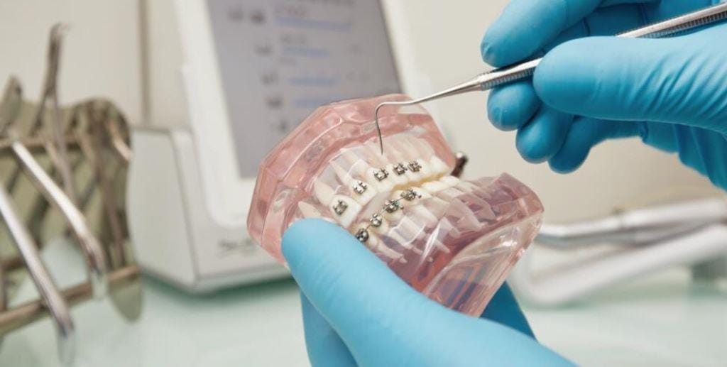 A clinician demonstrating fixed braces on a dental model