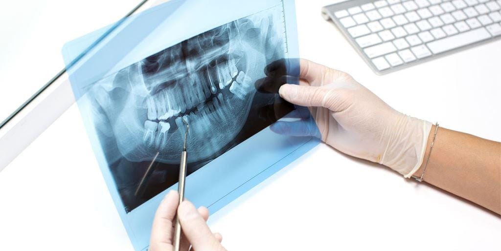 Gloved hands examining a panoramic dental X-ray