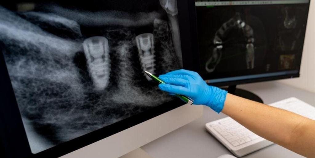 A gloved hand pointing to dental imaging on a screen