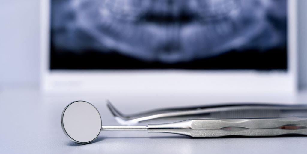 Dental instruments beside a screen displaying a dental X-ray