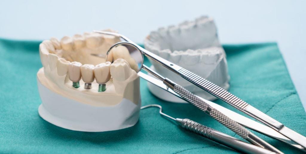 Dental models and instruments on a green surface